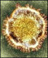 تاکنون موردی از "کرونا ویروس" در کشور گزارش نشده است
