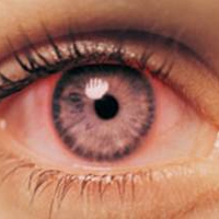 خشکی چشم بیشترین عامل مراجعه هنگام آلودگی هوا/ افزایش مراجعات اورژانس‌های چشم