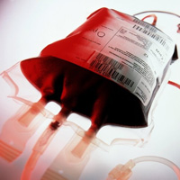 مردم برای اهدای خون به پایگاه‌های انتقال خون بشتابند