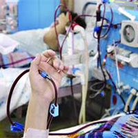 چگونگی خدمت‌دهی بیمارستان‌ها به بیماران دیالیزی در ایام عید اعلام شد