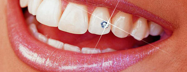 نگین‌ دندان عامل  پوسیدگی است