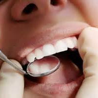 تعرفه کشیدن دندان و جرم گیری افزایش می‌یابد