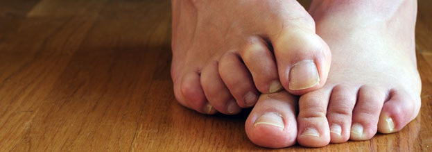 13 نکته برای داشتن پاهایی سالم در افراد دیابتی