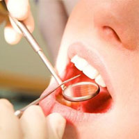 کاهش پوسیدگی دندان با مواد غذایی فیبردار