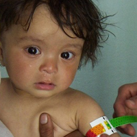 98 درصد کودکان دارای سوءتغذیه تحت پوشش امداد نیستند