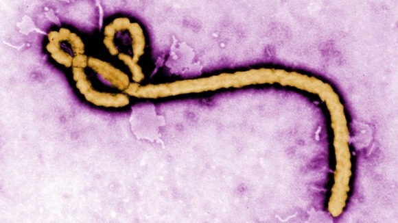 عکس/گرفتن تست ابولا از آقای رئیس‌ جمهور