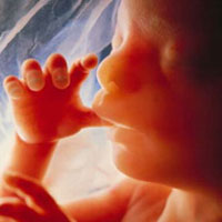 آلودگی‌هایی که موجب سقط جنین می‌شوند