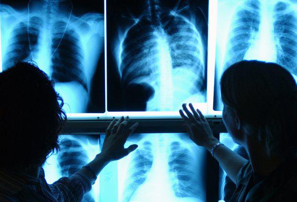 بیش از 600 دستگاه رادیولوژی تا پایان سال در بیمارستان‌های دولتی مستقر می‌شود
