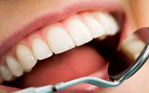 پوسیدگی دندان های ایرانی ها ۳ برابر شده است