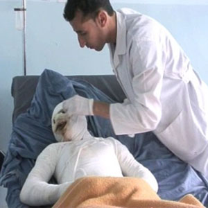 میزان مرگ و میر ناشی از سوختگی در کشور