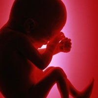 25 درصد بارداری‌ها به سقط جنین می‌انجامد