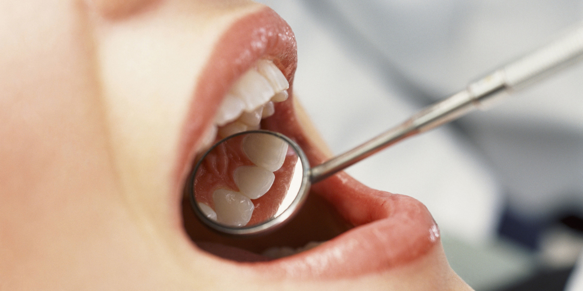 چرا دندان سالم درد میگیرد؟
