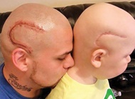 عکس/همدردی جالب پدری با کودک سرطانی اش