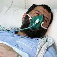 خودنمایی زخم کهنه جنایتکاران بر تن و جان مصدومان شیمیایی سردشت