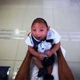 تولد اولین نوزاد مبتلا به میکروسفالی در فلوریدا