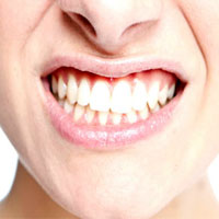 نسخه جادویی برای داشتن دندان های سفید