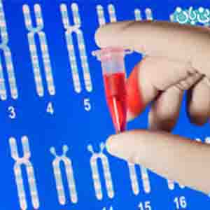 پیشنهاد اجباری شدن آزمایش ژنتیک قبل از ازدواج