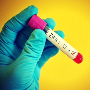 ویروس زیکا چه مدت در بدن باقی می‌ماند؟