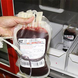 آزمایش تمام خون های اهدایی برای عدم آلودگی به ویروس زیکا