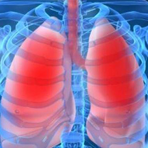 ارتباط شروع آسم در بزرگسالی و ابتلا به بیماری قلب