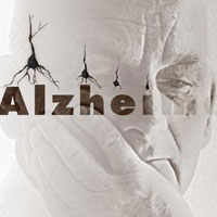 نشانه های مرحله به مرحله ابتلا به آلزایمر