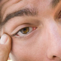 تشخیص بیماری ها از روی ترشحات چشمی
