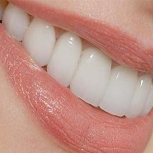 تبلیغات موزاییک کردن دندان‌ها به‌وسیله افراد سودجو صورت می‌گیرد