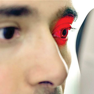 شایع ترین بیماری چشمی ایرانیان چیست؟