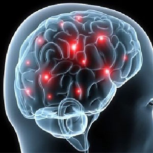 عاملی مهم در درمان سریع سکته مغزی