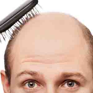 8 روش موثر برای پیشگیری از ریزش مو در مردان