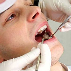 ساده‌ترین روش برای پیشگیری از پوسیدگی از دندان