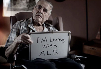 ALS (اسکلروز جانبی آمیوتروفیک) چیست؟