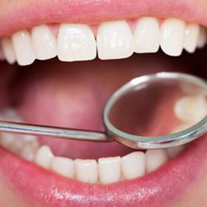 افزایش سهم خدمات دولتی دندانپزشکی