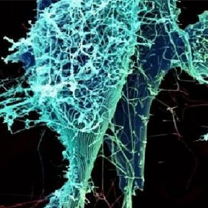 ویروس «ابولا» در ریه های بیمار تکثیر می شود