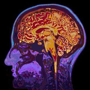 تشخیص ریسک خودکشی با اسکن مغز