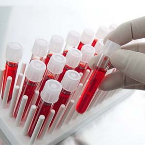 تشخیص سریع زیرگروه ام‌اس با آزمایش خون