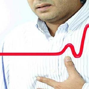 تصلب شرایین درجوانان وافزایش پنج برابری احتمال حمله قلبی