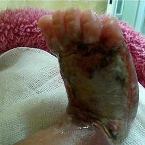 عکس/تزریق اشتباه نوزاد ۶ روزه را کباب کرد/ وضعیت عجیب همراه بیماران در بیمارستان دولتی