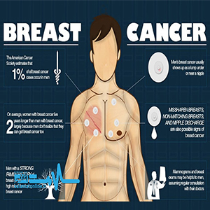 نشانه‌های سرطان پستان در مردان