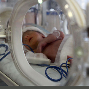احتمال ابتلا به بیماری‌های قلبی و ریوی در نوزادان نارس