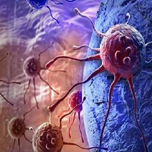 مرگبارترین بیماری های خودایمنی مرگبارترین بیماری های خودایمنی