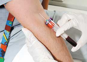 آزمایش جدید خون برای تشخیص سریع محل سرطان