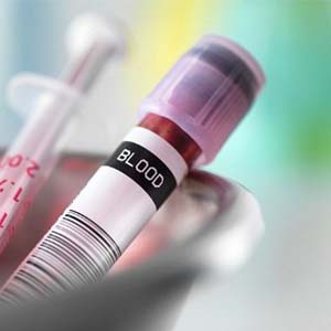 تشخیص محل تومور با آزمایش خون