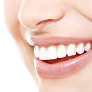 خدمات زیبایی دندانپزشکی به شرط سلامت حفره دهانی
