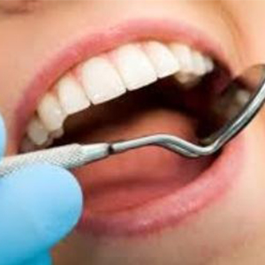 غلط جویدن سبب تخریب تاج دندان می‌شود/ علل سایش دندانی