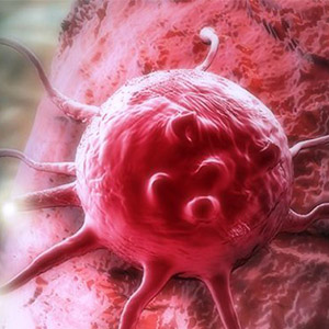 تولید ریزذراتی برای درمان نوعی سرطان در زنان
