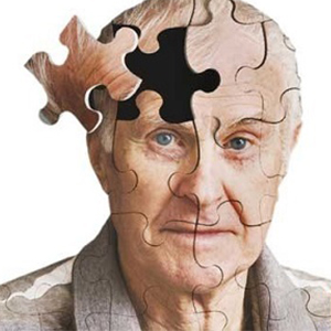 تشخیص زودهنگام آلزایمر با آزمون‌های مختلف