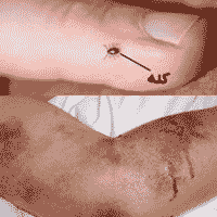 آزمایش فرد مشکوک به تب کریمه کنگو در بندرعباس منفی بود