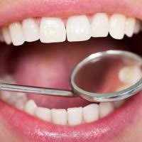 پوسیدگی دندان های ایرانی ها بیشتر شده است