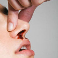 راه حل‌های خانگی برای توقف خونریزی بینی